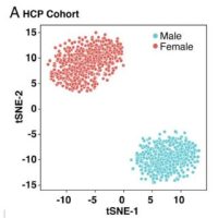 Female Differences in Human Brain